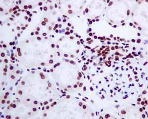 Immunohistochemistry (Formalin/PFA-fixed paraffin-embedded sections) - Anti-Histone H2A.Z antibody [EPR6171(2)(B)] - BSA and Azide free (AB208691)