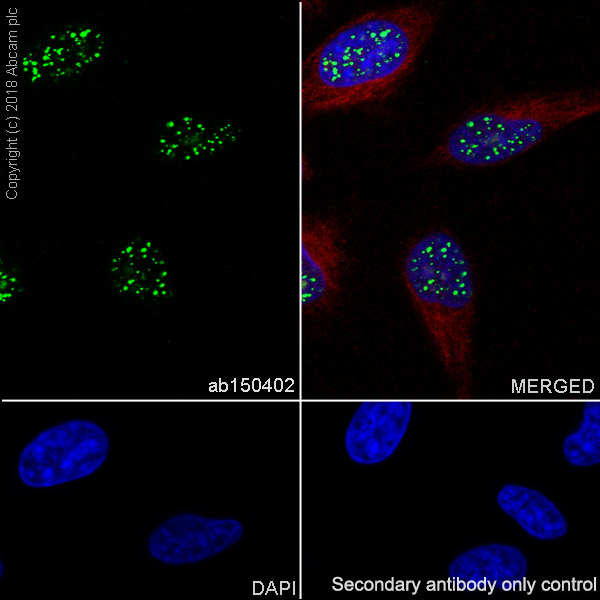 Anti-Histone H2A.Z antibody [EPR6171(2)(B)] - ChIP Grade