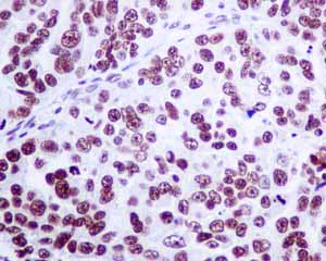 Immunohistochemistry (Formalin/PFA-fixed paraffin-embedded sections) - Anti-Histone H2A.Z antibody [EPR6171(2)(B)] - ChIP Grade (AB150402)