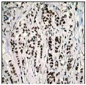 Immunohistochemistry (Formalin/PFA-fixed paraffin-embedded sections) - Anti-Histone H2B (acetyl K15) antibody [EP955Y] - ChIP Grade (AB62335)