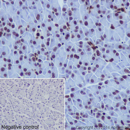 Immunohistochemistry (Formalin/PFA-fixed paraffin-embedded sections) - Anti-Histone H2B (acetyl K16) antibody [EPR17598] - ChIP Grade (AB177427)