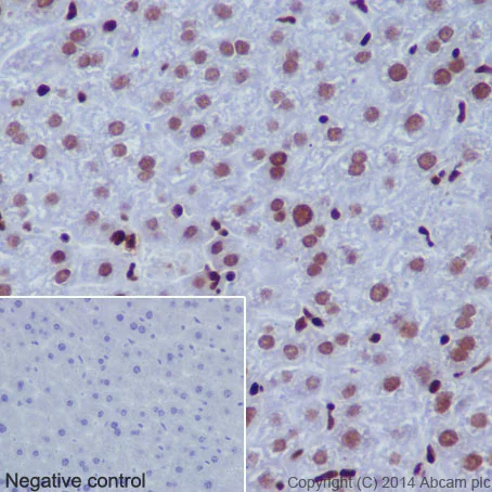 Immunohistochemistry (Formalin/PFA-fixed paraffin-embedded sections) - Anti-Histone H2B (acetyl K16) antibody [EPR17598] - ChIP Grade (AB177427)