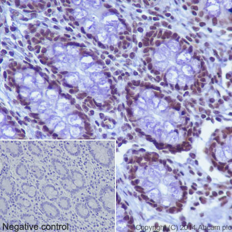 Immunohistochemistry (Formalin/PFA-fixed paraffin-embedded sections) - Anti-Histone H2B (acetyl K16) antibody [EPR17598] - ChIP Grade (AB177427)
