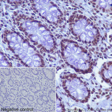 Immunohistochemistry (Formalin/PFA-fixed paraffin-embedded sections) - Anti-Histone H2B (acetyl K16) antibody [EPR17598] - ChIP Grade (AB177427)