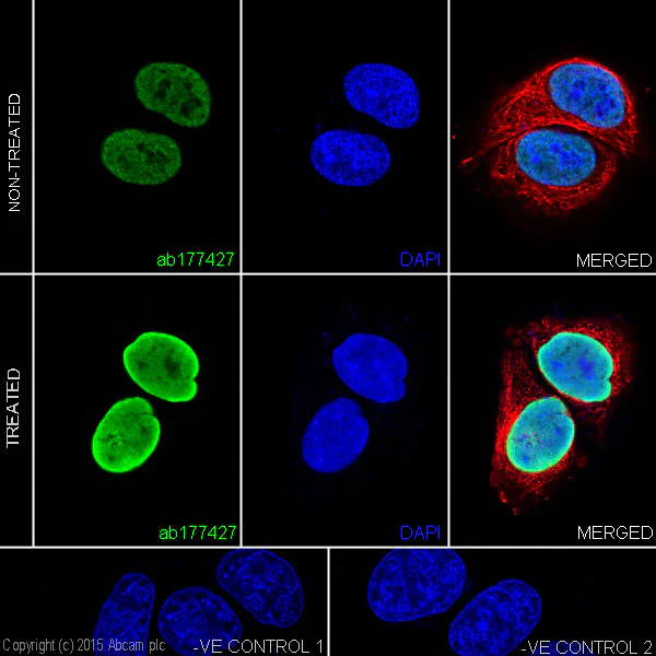 Immunocytochemistry/ Immunofluorescence - Anti-Histone H2B (acetyl K16) antibody [EPR17598] - ChIP Grade - BSA and Azide free (AB249968)
