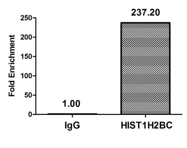 ChIP - Anti-Histone H2B (acetyl K20) antibody (AB240890)