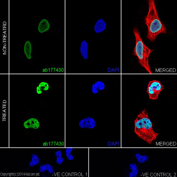 Immunocytochemistry/ Immunofluorescence - Anti-Histone H2B (acetyl K20) antibody [EPR859] - BSA and Azide free (AB240198)