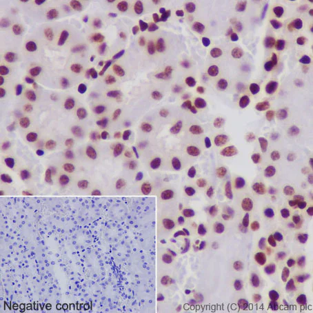 Immunohistochemistry (Formalin/PFA-fixed paraffin-embedded sections) - Anti-Histone H2B (acetyl K20) antibody [EPR859] - BSA and Azide free (AB240198)