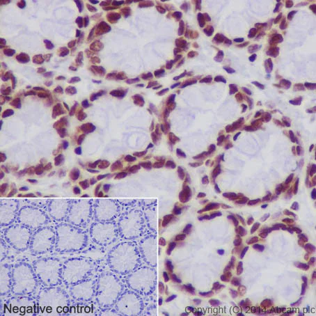 Immunohistochemistry (Formalin/PFA-fixed paraffin-embedded sections) - Anti-Histone H2B (acetyl K20) antibody [EPR859] - ChIP Grade (AB177430)