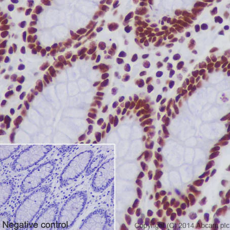 Immunohistochemistry (Formalin/PFA-fixed paraffin-embedded sections) - Anti-Histone H2B (acetyl K20) antibody [EPR859] - ChIP Grade (AB177430)