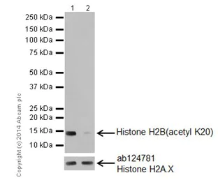 Western blot - Anti-Histone H2B (acetyl K20) antibody [EPR859] - ChIP Grade (AB177430)