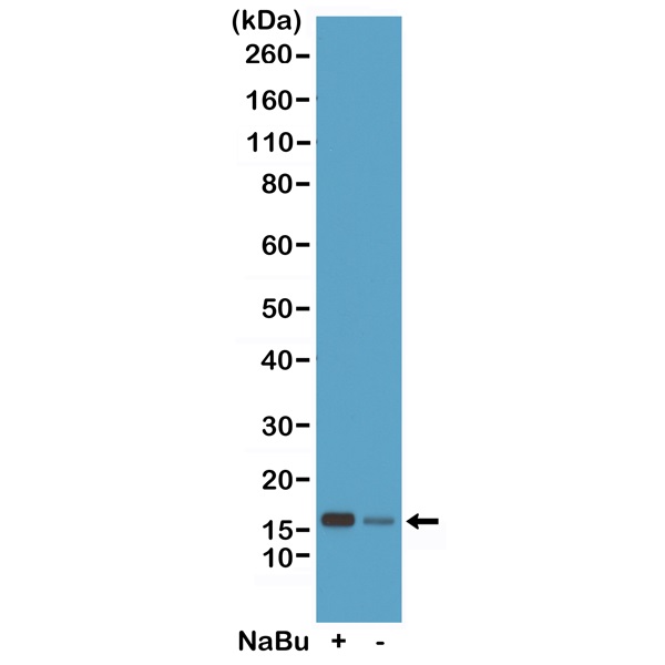Western blot - Anti-Histone H2B (acetyl K20) antibody [RM235] (AB271344), expandable thumbnail