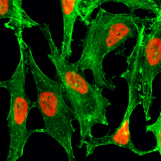 Immunocytochemistry/ Immunofluorescence - Anti-Histone H2B (acetyl K23) antibody [RM260] (AB222770)