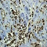 Immunohistochemistry (Formalin/PFA-fixed paraffin-embedded sections) - Anti-Histone H2B antibody [EP957Y] (AB52599)