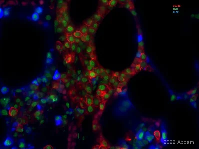 Immunohistochemistry (Formalin/PFA-fixed paraffin-embedded sections) - Anti-Histone H2B antibody [EP957Y] (AB52599)