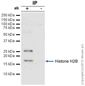 Immunoprecipitation - Anti-Histone H2B antibody [mAbcam 52484] - ChIP Grade (AB52484)