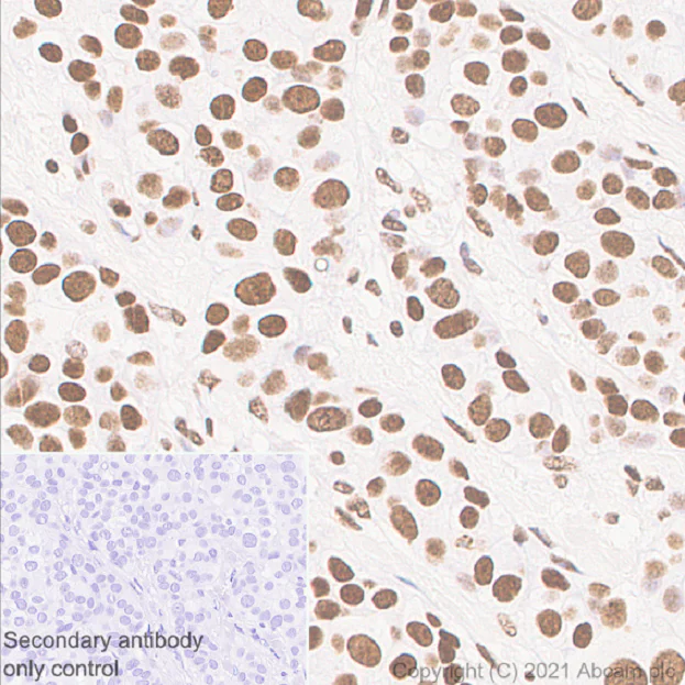 Immunohistochemistry (Formalin/PFA-fixed paraffin-embedded sections) - Anti-Histone H2B antibody [mAbcam 52484] - ChIP Grade - BSA and Azide free (AB237964)