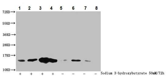 Western blot - Anti-Histone H2B (beta-hydroxybutyryl K11) antibody (AB240616)