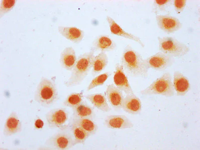 Immunocytochemistry - Anti-Histone H2B (beta-hydroxybutyryl K20) antibody (AB242276)