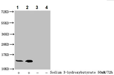Western blot - Anti-Histone H2B (beta-hydroxybutyryl K20) antibody (AB242276)