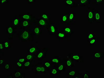 Immunocytochemistry/ Immunofluorescence - Anti-Histone H2B (butyryl K5) antibody (AB235429)