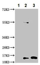 Immunoprecipitation - Anti-Histone H2B (butyryl K5) antibody (AB235429)