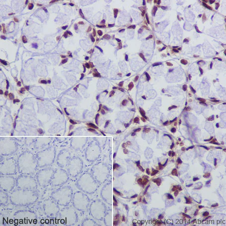 Immunohistochemistry (Formalin/PFA-fixed paraffin-embedded sections) - Anti-Histone H2B (crotonyl K12) antibody [EPR17593] (AB177420)
