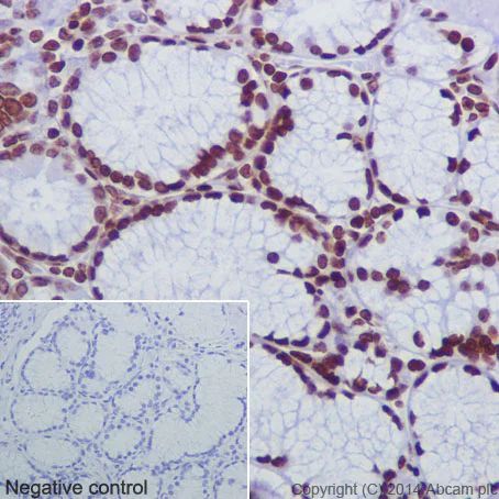 Immunohistochemistry (Formalin/PFA-fixed paraffin-embedded sections) - Anti-Histone H2B (crotonyl K12) antibody [EPR17593] (AB177420)