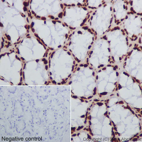 Immunohistochemistry (Formalin/PFA-fixed paraffin-embedded sections) - Anti-Histone H2B (crotonyl K12) antibody [EPR17593] - BSA and Azide free (AB203950)