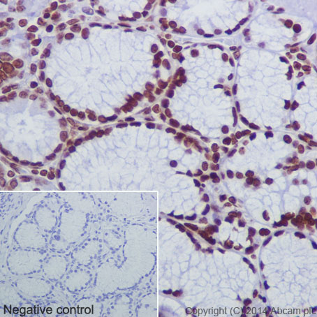 Immunohistochemistry (Formalin/PFA-fixed paraffin-embedded sections) - Anti-Histone H2B (crotonyl K12) antibody [EPR17593] - BSA and Azide free (AB203950)