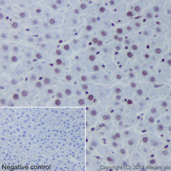 Immunohistochemistry (Formalin/PFA-fixed paraffin-embedded sections) - Anti-Histone H2B (crotonyl K5) antibody [EPR17483] (AB177396)