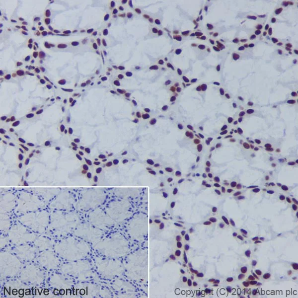 Immunohistochemistry (Formalin/PFA-fixed paraffin-embedded sections) - Anti-Histone H2B (crotonyl K5) antibody [EPR17483] (AB177396)