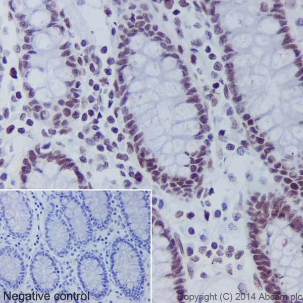 Immunohistochemistry (Formalin/PFA-fixed paraffin-embedded sections) - Anti-Histone H2B (crotonyl K5) antibody [EPR17483] - BSA and Azide free (AB249966)