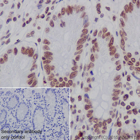 Immunohistochemistry (Formalin/PFA-fixed paraffin-embedded sections) - Anti-Histone H2B (formyl K108) antibody [EPR17697] - BSA and Azide free (AB249994), expandable thumbnail