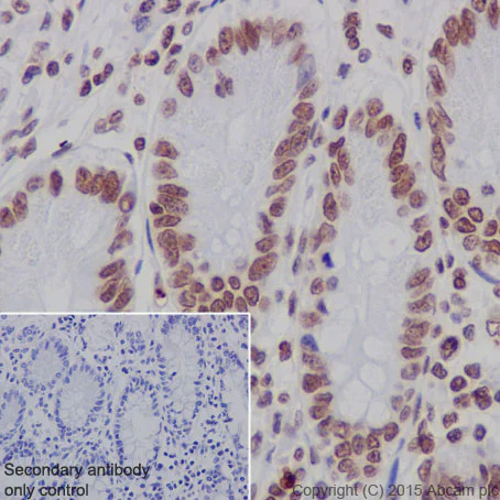 Immunohistochemistry (Formalin/PFA-fixed paraffin-embedded sections) - Anti-Histone H2B (formyl K108) antibody [EPR17697] - BSA and Azide free (AB249994)