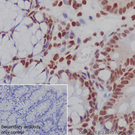 Immunohistochemistry (Formalin/PFA-fixed paraffin-embedded sections) - Anti-Histone H2B (formyl K108) antibody [EPR17697] - BSA and Azide free (AB249994)
