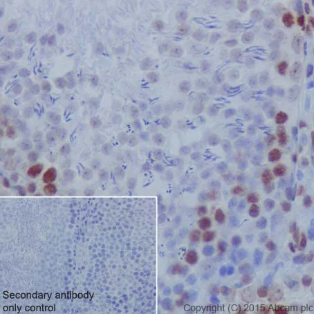 Immunohistochemistry (Formalin/PFA-fixed paraffin-embedded sections) - Anti-Histone H2B (formyl K120) antibody [EPR17701] (AB177788)