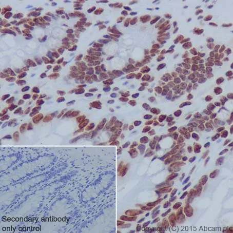 Immunohistochemistry (Formalin/PFA-fixed paraffin-embedded sections) - Anti-Histone H2B (formyl K120) antibody [EPR17701] - BSA and Azide free (AB249997)