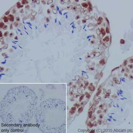 Immunohistochemistry (Formalin/PFA-fixed paraffin-embedded sections) - Anti-Histone H2B (formyl K120) antibody [EPR17701] - BSA and Azide free (AB249997)