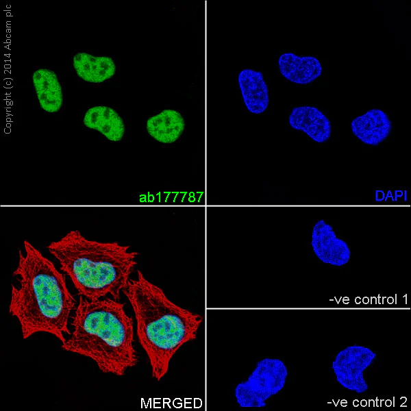 Immunocytochemistry/ Immunofluorescence - Anti-Histone H2B (mono methyl K116) antibody [EPR17700] (AB177787)