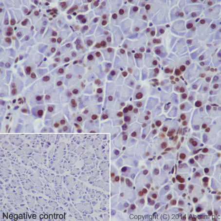 Immunohistochemistry (Formalin/PFA-fixed paraffin-embedded sections) - Anti-Histone H2B (mono methyl K116) antibody [EPR17700] (AB177787)
