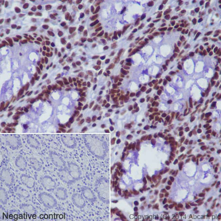 Immunohistochemistry (Formalin/PFA-fixed paraffin-embedded sections) - Anti-Histone H2B (mono methyl K116) antibody [EPR17700] (AB177787)