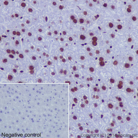 Immunohistochemistry (Formalin/PFA-fixed paraffin-embedded sections) - Anti-Histone H2B (mono methyl K116) antibody [EPR17700] - BSA and Azide free (ab249996), expandable thumbnail