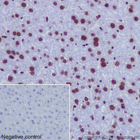 Immunohistochemistry (Formalin/PFA-fixed paraffin-embedded sections) - Anti-Histone H2B (mono methyl K116) antibody [EPR17700] - BSA and Azide free (AB249996)