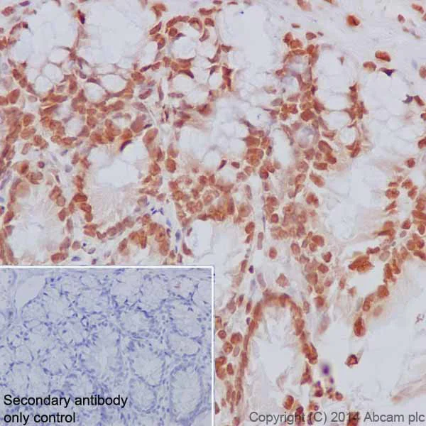 Immunohistochemistry (Formalin/PFA-fixed paraffin-embedded sections) - Anti-Histone H2B (mono methyl K5) antibody [EPR18092] (AB188340)