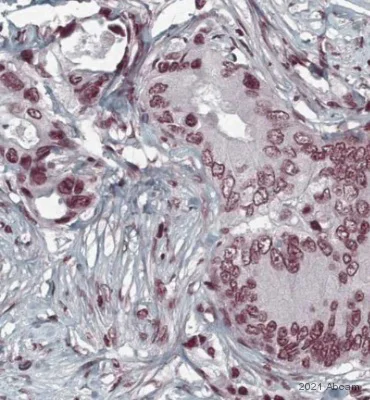 Immunohistochemistry (Formalin/PFA-fixed paraffin-embedded sections) - Anti-Histone H2B (mono methyl K5) antibody [EPR18092] (AB188340)