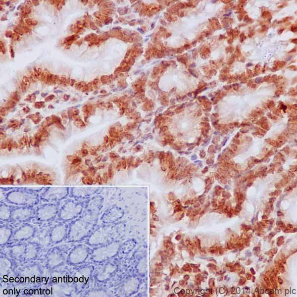 Immunohistochemistry (Formalin/PFA-fixed paraffin-embedded sections) - Anti-Histone H2B (mono methyl K5) antibody [EPR18092] - BSA and Azide free (ab250960), expandable thumbnail