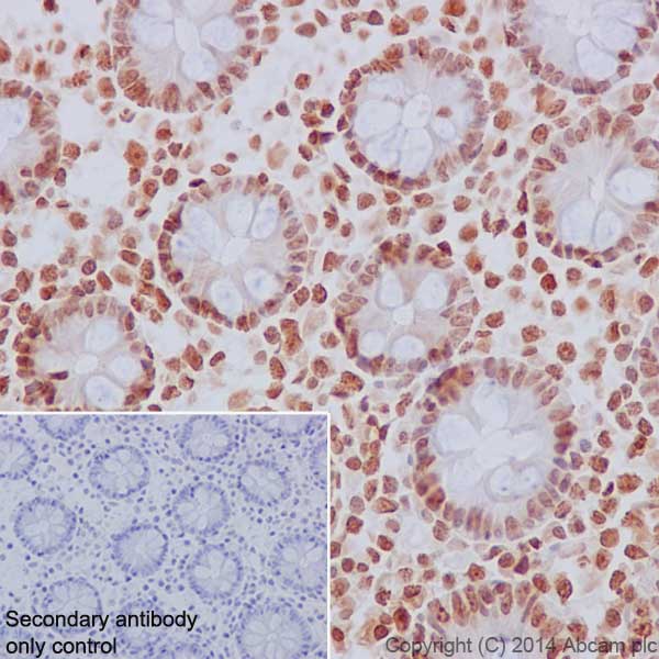 Immunohistochemistry (Formalin/PFA-fixed paraffin-embedded sections) - Anti-Histone H2B (mono methyl K5) antibody [EPR18092] - BSA and Azide free (ab250960), expandable thumbnail