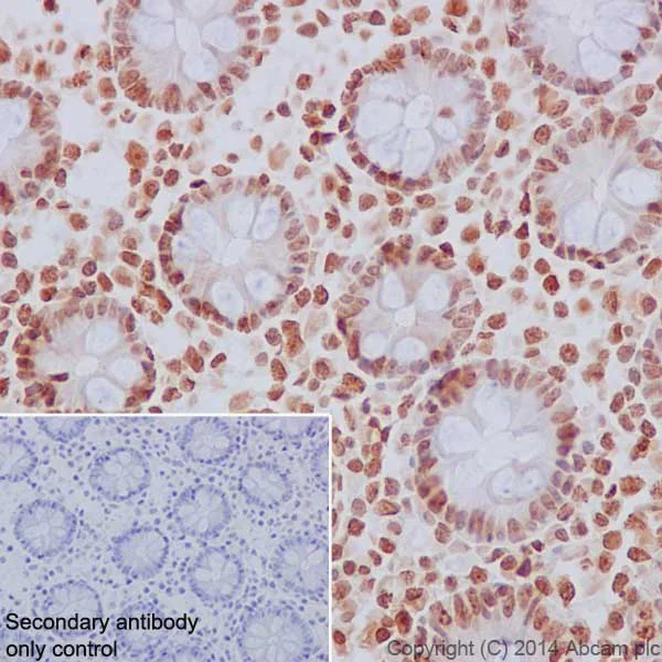 Immunohistochemistry (Formalin/PFA-fixed paraffin-embedded sections) - Anti-Histone H2B (mono methyl K5) antibody [EPR18092] - BSA and Azide free (AB250960)