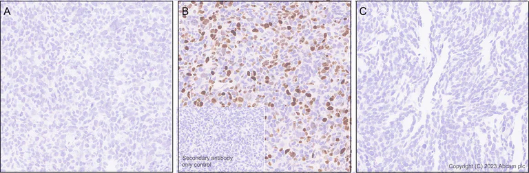 Immunohistochemistry (Formalin/PFA-fixed paraffin-embedded sections) - Anti-Histone H2B (mutated E76K) antibody [EPR27298-41] (AB313789)
